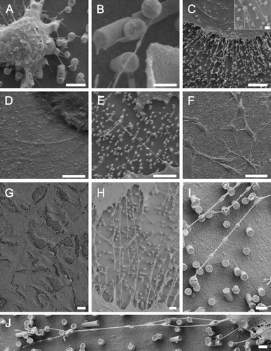 Figure 3.  Astrocytes growing on nano-lawns (SEM images). Astrocytes make contact to metal pillars via nanotubular membrane protrusions within 10 min (A, B). They extend nanotubes to distant metal pillars via neighboring pillars while maintaining contact to pillars that were reached before (C). Nanotubes appear straightened in between two attachment points on metal pillars while their correspondent structures grown on poly-L-lysin coated glass surfaces are randomly coiled (D). Nanotubes may extend over several µm at a diameter of about 100 nm (E) but may develop into very long tubes (>100 µm) at a higher diameter which is still <1 µm (F). Astrocytes grow to confluency by making contact to cells further away (G). It can be assumed that astrocytes first bridge the gaps between cells by nanotubular protrusions before closing them with more cellular material (H). Apparently, the material necessary to prolong these nanotubes was transported along the nanotubes in gondola-like structures (H–J) which have been observed as early as 10 min after start of culture (B). Scale bars in A, B, C, D, E, F, G, H and I represent 2, 0.8, 10 (insert: 1), 200, 8, 20, 20, 2, 1 and 1 µm, respectively. Nanostructures were gold (A, B, C, E) or platinum (F, G, H, I, J).
