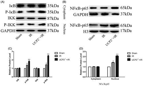 Figure 4. Detection of NFκB pathway changes in renal tissue by Western blotting. AC: UCP2 prevents IRI by inhibiting cytoplasmic IκB and IKK phosphorylation. BD: UCP2 inhibits NFκB. (The internal references are GAPDH (cytoplasm) and histone H3 (nucleus). The greyscale value of each group is compared with the internal reference, and the obtained result is compared with the sham group. In each group of six mice, the data are expressed as the mean ± standard deviation (±S). *p < 0.01, compared with sham; **p < 0.01 compared to IR group).