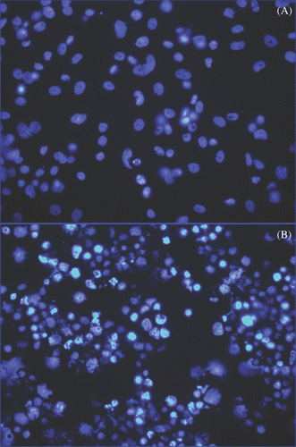 Figure 9. Detection of apoptosis using nuclear morphology in SK-BR-3 cells incubated with Herceptin-directed nanoparticles before and after AMF irradiation. Live SK-BR-3 were incubated with Herceptin-directed nanoparticles for 3 h and then washed and sham treated (A) or AMF treated (B) as above. Cells were fixed and stained 24, 48 (not shown) and 72 h later, using DAPI to stain DNA. Less than 1% of apoptotic cells were seen in sham exposed cultures, but cells that were AMF irradiated had significant apoptosis noted at 72 h.