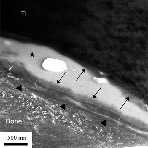 Figure 8. TEM bright-field image of the sample. The arrows show the apatite layer (∼200 nm) closest to the implant surface. The arrowheads show a layer with high diffraction contrast, containing HA crystals (∼200 nm). (*Artifact of preparation).
