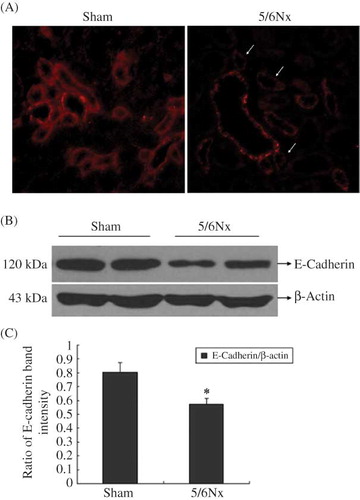 Figure 2. Expression of E-cadherin in kidney frozen sections and tissues. (A) The localization of E-cadherin in frozen sections was determined by IF (200×) with E-cadherin antibody (red). (B) Western blot analysis of E-cadherin in kidney tissues. Lanes 1 and 2 are sham operation group and lanes 3 and 4 are 5/6Nx group. (C) E-cadherin protein levels. Data were expressed versus β-actin and compared with ANOVA.Note: *Denotes p < 0.05 versus sham operation group.