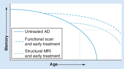 Figure 2. Graph showing the potential role of functional and structural imaging in AD diagnosis and treatment.The unbroken line represents the untreated natural progression, the dashed line represents earlier treatment based on structural MRI and the dotted line represents earlier treatment based on functional MRI. The gray box in the bottom right corner represents the onset of AD.Modified with permission from one provided by Dr Gary Small.AD: Alzheimer’s disease.