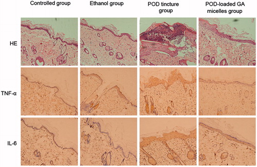 Figure 8. HE-staining graphs showing the histological changes of the skin; the immunohistochemical photograph showing the difference between the skin groups treated with physiological saline, 75% ethanol, POD tincture, and POD-loaded GA micelles formulation (magnification,  ×200).