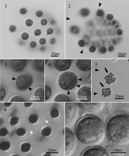 Figs. 1–7 Light microscopy of an aplanosporic strain of Eudorina unicocca originating from Lake Tsukui, Kanagawa, Japan (TKI-C-2). Fig. 1. Surface view of 32-celled vegetative colony. Note a single, basal pyrenoid (P) in the chloroplast of each cell. Fig. 2. Optical section of 32-celled vegetative colony. Arrowheads indicate colonial envelope surrounding whole colony. Fig. 3. Surface view of vegetative cell, showing contractile vacuoles (arrowheads) distributed in the protoplast surface. Fig. 4. Optical section of vegetative cell, showing a single large pyrenoid (P) in the chloroplast, and contractile vacuoles (arrowheads) distributed in the protoplast surface. Fig. 5. Daughter colony formation in asexual reproduction. Note each cell is enclosed by a transparent vesicle or cellular envelope (arrows) within the parental gelatinous matrix (arrowheads). Fig. 6. Vegetative colony stained with methylene blue. Individual cellular sheaths of the colonial gelatinous matrix (asterisks) are apparent. Fig. 7. Mature aplanospores 27 days after transferring into nitrogen-deficient medium.