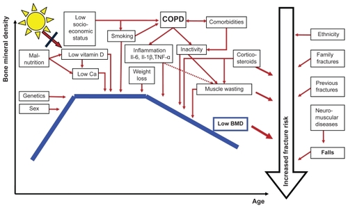 Figure 1 The development of bone mineral density (BMD) throughout life, factors of importance for level of BMD (genetics, sex), COPD-related factors lowering (BMD), and important factors influencing fracture risk in addition to level of BMD.