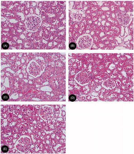 Figure 1. Representative renal histomorphological changes: (A) NN, normal diet group; (B) HN, high cholesterol diet group; (C) HH, high cholesterol plus contrast media; (D) HM, high cholesterol plus diatrizoate plus MTP131 group; (E) HS: high cholesterol plus diatrizoate plus SPI20 group (HE staining, original magnification ×200).