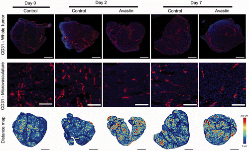 Figure 3. Microvascular analysis of control and bevacizumab-treated tumours. Top row: Whole tumour sections with CD31 immunohistochemistry identifying endothelial cells (red) and DAPI indicating tumour nuclei (blue). Middle row: Higher magnification images of tumour sections shown in the top row. Bottom row: Distance maps indicating the distance between a tumour cell and the nearest vascular surface. Large distances (up to 200 µm) are shown in red while short distances are shown in blue. Bar is 2 mm for top and bottom row and 200 µm for middle row.