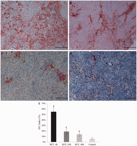 Figure 7. Immunohistochemistry for caspase-3 in the tumour from the treatment group (A–C) and the control group II (D). In the treatment group, moderate cytoplasmic immunostaining in most of the tumour cells, and strong immunostaining in a few scattered cells, at 4 h (A), 24 h (B) and 48 h (C) after the treatment; the decrease in the number of apoptotic cells is evident. Comparatively, samples from control group II showed a lower staining (D). Bar = 12.5 µm. The immunohistochemistry index is also shown (E).