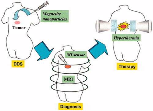 Figure 3. Scheme of the treatment strategy using magnetic nanoparticles (MNPs). Functionalized MNPs accumulate in the tumor tissues by the drug delivery system (DDS) (Sun et al. Citation2008)
