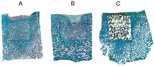 Figure 5. Histological specimens exemplifying the characteristic healing patterns for the 3 groups: autograft (A), collagen carrier (B), and PCL scaffold (C). The intended FAVER section is illustrated in C, where a hyper-dense groove after the centripetal Kirschner wire can be seen. Because no statistically significant differences were found with histomorphometry, random sections with or without EPO are shown.