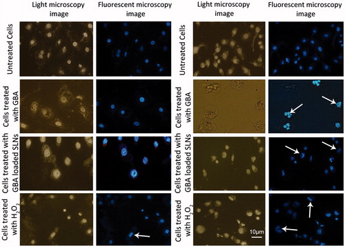 Figure 6. Light and fluorescent microscopy images of A549 cells and HUVEC stained with DAPI; (A) the HUVEC and (B) A549 cell line are shown. The arrows show fragmented nucleus in the treated cells.