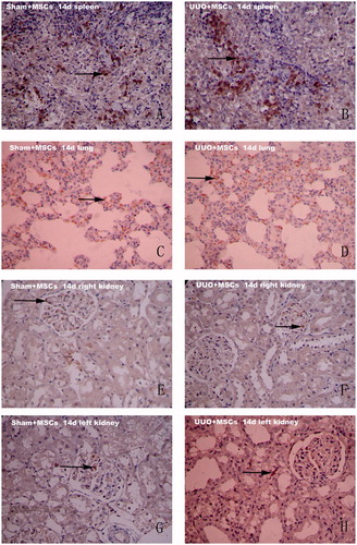 Figure 2. Immunohistochemical staining results (×200). MAB1281 positive cells in the spleen, lung, right kidney and left kidney in both groups at day 14 after surgery. Sham + MSC group spleens (A) and lungs (C), UUO + MSC group spleens (B) and lungs (D) all showed a large number of positively staining brown cells; (E): In Sham + MSC group, the right kidney occasionally showed positively staining brown cells; (F): In UUO + MSC group, the right kidney glomeruli occasionally showed positively staining brown cells; (G): In Sham + MSC group, the left kidney occasionally positively staining brown cells in the glomeruli; (H): In UUO + MSC group, the left kidney showed a small amount of positively staining brown cells. Most positive cells were in the renal interstitium. Arrows indicate MAB1281 positive cells.