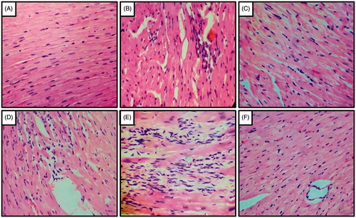 Figure 4. Effect of captopril and FLC on DOCA-salt induced alteration in heart histology of rats. Photomicrograph of sections of heart of (A) UNTZD rats showed normal cardiac muscle fibers, (B) UNTZD + DOCA-salt control showed severe myocardial degeneration, hypertrophy and infiltration of inflammatory cells, (C) UNTZD + DOCA-salt + captopril (30 mg/kg) showed minimal myocardial degeneration and infiltration of inflammatory cells, (D) UNTZD + DOCA-salt + FLC (200 mg/kg) showed no significant change in myocardial tissues, (E) UNTZD + DOCA-salt + FLC (400 mg/kg) showed decrease in myocardial degeneration and infiltration of inflammatory cells, and (F) UNTZD + DOCA-salt + FLC (800 mg/kg) showed significant reduction in myocardial degeneration and infiltration of inflammatory cells. Hematoxylin and eosin staining (at 40×).
