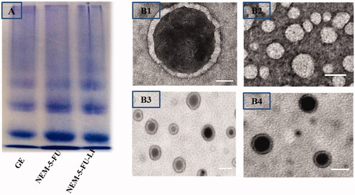 Figure 2. SDS-PAGE and TEM of ghost erythrocytes, nanoerythrocyte membrane and hybrid nanoerythrocyte-membrane-coated liposomes. (Scale bar for TEM = 100 nm).