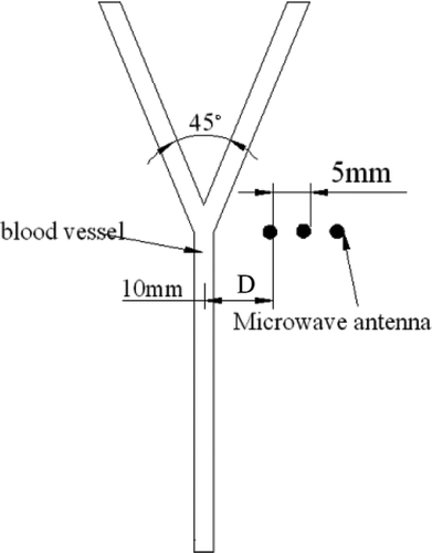 Figure 3. Positions of the microwave antenna.
