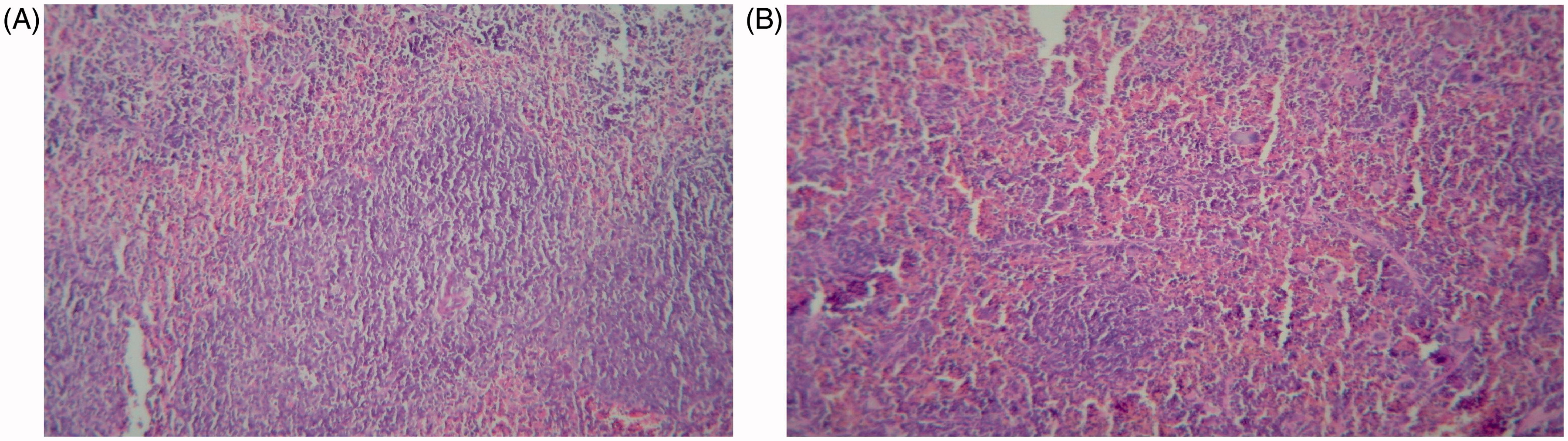 Figure 2. Pathologic changes in spleen after administration of 10 mg BBR/kg/day. (a) Vehicle-control group: White pulps with well-formed lymphoid follicles containing active germinal centers. (b) 10 mg BBR/kg/day group: Atrophic white pulps with relatively small lymphoid follicles. Each figure is a representative photomicrograph from a mouse in each group. Magnification = 100×.