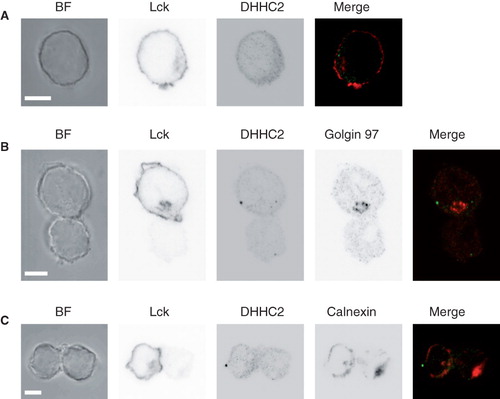 Figure 6. DHHC2 localization in resting and activated Jurkat T cells. (A) Brightfield (BF) and confocal microscopy images of DHHC2 and Lck detected by immunostaining in Jurkat T cells. Scale bars = 5 μm. (B) and (C) BF and confocal immunofluorescence images of Jurkat T cells (top in B, left in C; marked with anti-Lck) conjugated with SEE-loaded Raji B cells. Greyscale images are shown for clarity. In (B) the Golgi apparatus is visualized by staining with anti-Golgin 97 and in (C) the ER is visualized by staining with anti-calnexin. Merged images are also shown; green – DHHC2; red – Golgin 97 (B) or calnexin (C). Accumulation of Lck at the T-B cell interface confirms productive formation of the immunological synapse. Images are representative of n = 23 (B) and n = 24 (C) cell pairs. Scale bars = 5 μm.