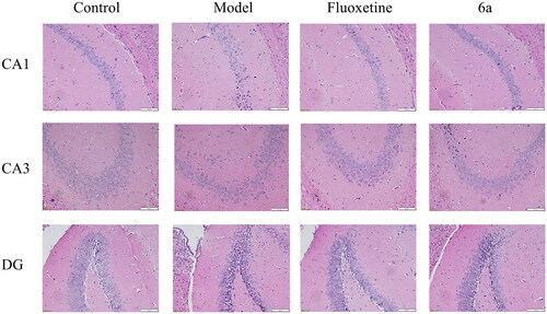 Figure 9. Histomorphological appearance of the CA1, CA3, and DG regions in the mouse hippocampi. H&E staining, original magnification ×200, scale bar 100 μm. Control and Model (saline, 10 ml/kg), fluoxetine (20 mg/kg), and compound 6a (40 mg/kg).
