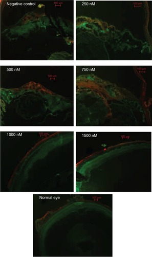 Figure 6 Immunofluorescence analysis of RPE65 and GS 4 weeks after siRNA-PKCα injection.Notes: There are faint expressions of RPE65 (red) and GS (green) in normal retinas; these expressions seemed most pronounced in the epiretinal membranes in the negative control, as well as in the 250 nM, 500 nM, and 750 nM groups when compared to the 1000 and 1500 nM groups. Scale bar: 100 μm.Abbreviations: RPE, retinal pigment epithelium; GS, glutamine synthetase.