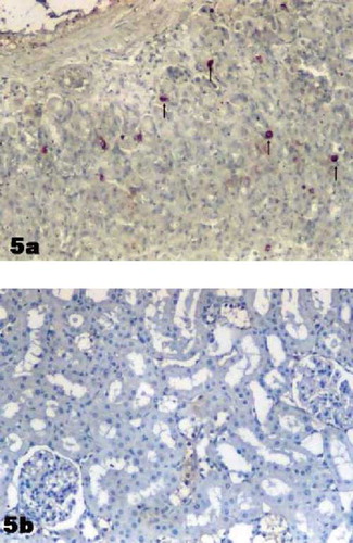 Figure 5. (a) Positive control. Ghrelin immunoreactive cells in stomach. (→). (b) Negative control section in renal cortex. Magnification: ×10.