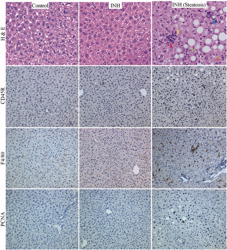 Figure 4. H&E and immunohistochemical staining for anti-CD45R, F4/80, and PCNA in livers of Cbl-b−/− mice treated with INH (0.2% w/w in food) for 5 weeks. Control = untreated mice (n = 4); INH = mice treated with INH that did not develop abnormal liver histology (n = 3); INH steatosis = one mouse treated with INH that developed significant abnormal liver histology (n = 1). Red arrow = lymphocyte infiltration, yellow arrow = microvesicular steatosis, green arrow = macrovesicular steatosis, blue arrow = focal necrosis, orange arrow = cholestasis. 40× magnification for H&E; 20× magnification for CD45R, F4/80, and PCNA.