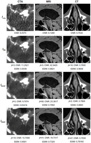Figure 2 Images filtered with PM, NCDF, and RBAF.
