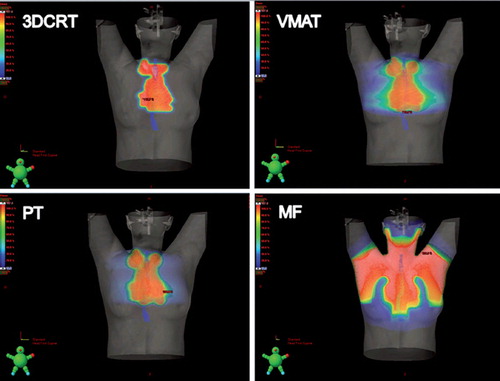 Figure 1. Treatment plans with 3DCRT, VMAT, PT and MF for one patient shown in dose color wash. The esophagus is delinated in blue.