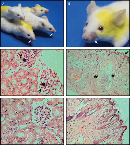 Figure 5. Liposomes with non-bilayer phospholipid arrangements induced by Mn2+ cause an autoimmune disease resembling human lupus in mice. (A) and (B) Representative photographs of 6-month-old female BALB/c mice treated with phosphatidylcholine/phosphatidic acid liposomes with non-bilayer phospholipid arrangements induced by Mn2+, showing facial lesions (mice are identified by marks made with a picric acid solution, which show as yellow colouring). (C) Glomeruli with mesangial hypercellularity (asterisks) and thickening of capillary walls (arrows). (D) Skin from alopecic areas showing epidermal atrophy (arrows), and widening of hair bulb fibrous sheath (asterisks) with total disorganization of matrical cells. In contrast, there are not histological abnormalities in kidney (E) or skin (F) from control mice treated with phosphatidylcholine/phosphatidic acid liposomes (H/E, 40× in all panels).