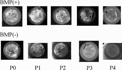 Figure 3. Radiographs of diffusion chambers with the cells (passages P0–P4) of the BMP(+) and BMP(-) groups at 4 weeks after transplantation. Numerous radioplaque configurations that indicate mineralized structures can be seen in the BMP(+) group compared to the BMP(-) group, although the numbers of calcifications decreased with passage in both groups. The figure shows one representative result from a total of 6 different samples at each passage.