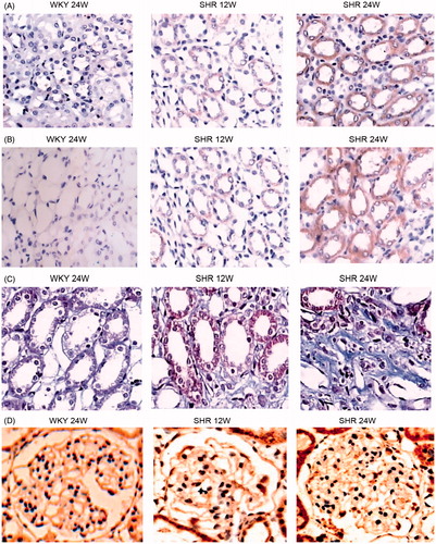 Figure 2. Immunohistochemical staining for CTGF, α-SMA, Collagen-III and PCX in SHR and WKY glomerular. Immunocytochemistry of CTGF (A), α-SMA (B), Collagen-III (C), PCX (D) in kidney.