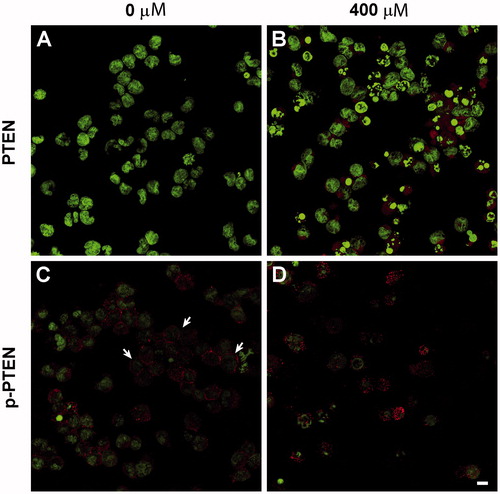 Figure 7. PTEN and phosphorylated PTEN expression in NK cells treated with V2O5 for 24 h. Confocal microscopy images of cells sorted by cytometer. (A, C) Non-stimulated cells. (B, D) Cells treated with 400 µM V2O5. Nucleic acid staining with DAPI (green). Arrows in C indicate membrane location of pPTEN, which is lost in cells exposed to V2O5. Magnification = 60×.
