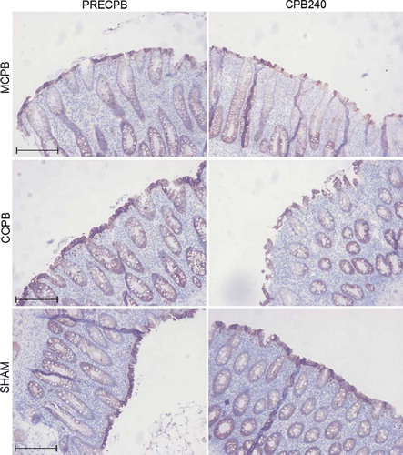 Figure 4. Micrographs of sections of colon biopsies showing immunohistochemical staining for claudin-4 (CL4) in the minimized cardiopulmonary bypass (MCPB) (first row), conventional cardiopulmonary bypass (CCPB) (second row) groups and in a sham animal (third row) at baseline and at 240 minutes on cardiopulmonary bypass (CPB). Bar = 250 μm.