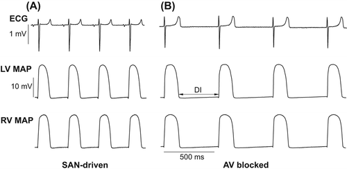 Figure 1. Representative ECG and MAP recordings obtained from SAN-driven (panel A) and AV-blocked (panel B) heart preparations. Volume-conducted ECG and RV epicardial MAPs were recorded simultaneously in spontaneously beating heart preparations from two study groups. In panel B (middle trace) the double arrow shows diastolic interval.