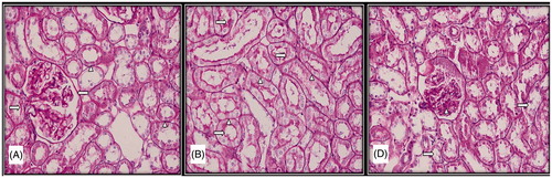 Figure 2. Light microscopic micrographs of rat kidney sections stained with PAS from control (A), sham (B), and experimental (D) rats. (A) Bowman capsule (left arrow), proximal and distal tubule basement membranes (arrowhead) and proximal tubule bristle edge structure (right arrow) of kidney glomeruli with normal histological structure in the histological sections of the control group. (B) Proximal and distal tubule basement membranes (arrowhead) and proximal tubule bristle edge structure (right arrow) with normal histological structure in the histological sections of the sham group. (D) Brush edge loss (right arrow) and dense PAS (+) mesangial cells (arrowhead) in the proximal tubule epithelium.