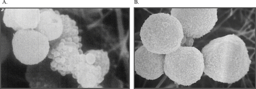 Figure 8 Reversibility of initial damage to hepatocytes. Freshly isolated hamster hepatocytes were exposed to acetaminophen for 90 min (A) and then incubated with the thiol reductant dithiothreitol (DTT) for a further 90 min (B). Despite morphological damage after 90 min, as evidenced by substantial plasma membrane blebbing, hepatocytes could be restored to normal morphology (and function) over the subsequent incubation with DTT, demonstrating that the effects observed at 90 min were fully reversible. If cells were incubated in buffer alone for the second 90 min period there was a marked loss of viability (CitationTee et al., 1986).
