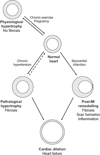 Figure 1. Cardiac remodelling plays a crucial role during development of heart failure. Cardiac remodelling occurs most commonly as a result of either prolonged hypertension or myocardial infarction and also in physiological conditions, such as during pregnancy.