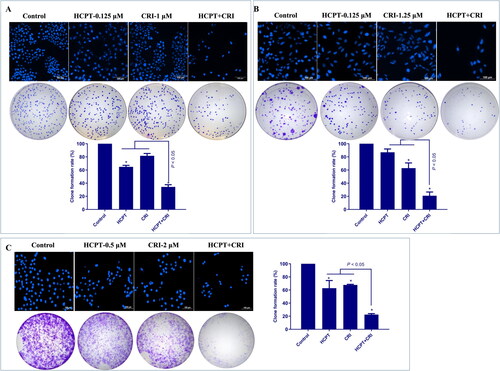 Figure 2. The morphological features of cancer cells and effect on cancer cells proliferation after HCPT and CRI alone or in combination treatment. The fluorescence intensity and colony formation of H460 (A), H1975 (B), and HCC827 (C) cells were significantly decreased when treated with HCPT and CRI. *p < 0.05, vs control group.