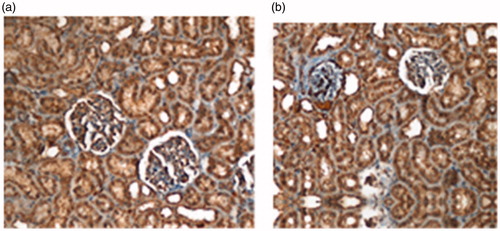 Figure 4. Photomicrographs of the Bax immunohistochemical stained kidneys from (a) sham exposed and (b) pre-natal group.