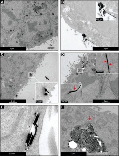 Figure 3 TEM images of colon cancer cells incubated for 1 hour with Ni NWs.Notes: (A) Control cells (cells to which no NWs were added) with organelles such as M, GA, N, PM, and LD. (B) NWs in close proximity to the PM of colon cancer cells. Cells that internalized NWs as aggregates (C) and as single NWs (D). PM surrounding indivdual NWs are visible (red arrows). (E and F) Fully internalized NWs. A few NWs can be observed fully surrounded by a membrane vesicle (E) and a fully internalized large aggregate of NWs caused the reordering of organelles like the GA (red arrow) (F).Abbreviations: GA, Golgi apparatus; LD, lipid droplets; M, mitochondria; N, nucleus; NW, nanowire; PM, plasma membrane; TEM, transmission electron microscopy.