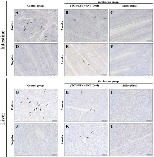Figure 4. Immunohistochemistry of duck organs after vaccination. Ducklings were orally vaccinated and two organs, intestine (upper) and liver (lower) were isolated for IHC staining by using anti-VP2 antibody. The GPV-infected animal sample (A and G) and non-infected tissues (D and J) served as positive and negative controls, respectively. Tissues from the pTCY/GPV + PNT oral vaccinated (B, E, H, and K) and the saline mock vaccinated (C, F, I, and L) group ducklings are shown. Arrows indicate VP2-positive cells.