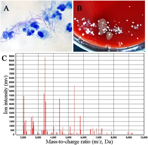 Figure 2. Pathogenic examination. (A) Acid fast staining showed it was weakly acid-fast with a filamentous appearance. (B) Bacterial colonies on rabbit blood agar after incubation at 37 °C for 24 h. (C) Matrix-assisted laser desorption/ionization-time of flight (MALTID-TOF) mass spectrometry showed it was Nocardia brasiliensis.
