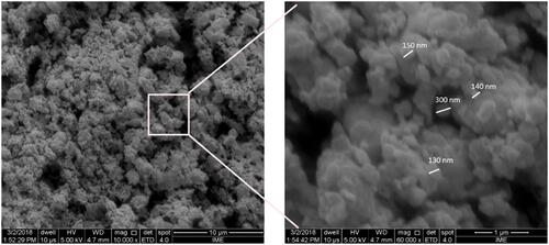 Figure 2 Scanning electron photomicrography showing nano-HA/ß-TCP mixture with particles size from 130 to 300µm. X 10.000, X 60.000.