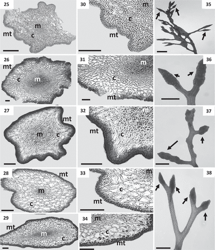 Figs 25–38. Cross sections of thalli and details of receptacles of Cystoseira 1 (= Cystoseira sensu stricto) from the Canary Islands. Figs 25–29. Primary branches. Fig. 25. Cystoseira sp. (= C. aurantia) (TFC Phyc 15276). Fig. 26. Cystoseira foeniculacea (TFC Phyc 15266). Fig. 27. Cystoseira humilis (TFC Phyc 15267). Fig. 28. Cystoseira compressa (TFC Phyc 15263). Spring-summer morphotype. Fig. 29. Cystoseira compressa (TFC Phyc 15291). Rosette morphotype. Figs 30–34. Details of the three vegetative tissues. Fig. 30. Cystoseira sp. (= C. aurantia) (TFC Phyc 15276). Fig. 31. Cystoseira foeniculacea (TFC Phyc 15266). Fig. 32. Cystoseira humilis (TFC Phyc 15267). Fig. 33. Cystoseira compressa (TFC Phyc 15263). Fig. 34. Cystoseira compressa (TFC Phyc 15291). Figs 35–38. Warty fusiform receptacles (arrows). Fig. 35. Cystoseira sp. (= C. aurantia) (TFC Phyc 15276). Fig. 36. Cystoseira foeniculacea (TFC Phyc 15266). Fig. 37. Cystoseira humilis (TFC Phyc 15267). Fig. 38. Cystoseira compressa (TFC Phyc 15263). Meristoderm (mt), cortex (c) and medulla (m). Scale bars: Figs 25–34 = 100 μm; Figs 35–38 = 1 mm.