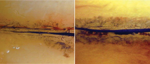 Figure 2. Microangiography 1 week after surgery; newly formed vessels could be seen along the implanted vascular bundle in the control group (left panel) and in the experimental group (right panel).