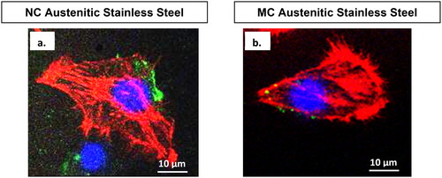 Figure 7. Confocal micrographs show combined distribution of cytoskeletal organisation and focal adhesion contacts. Actin (red), vinculin (green) and nucleus (blue) in fibroblasts cultured for 2 days on NC (a) and MC (b) stainless steel surfaces. The focal contact sites where vinculin is linked at the actin leading edges, which connect cells to the steel surface (adapted from references 37, 40).