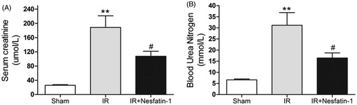 Figure 1. Effects of nesfatin-1 on renal function at 24 h after renal I/R injury. Serum creatinine (A) and blood urea nitrogen (B) concentrations were significantly higher in the saline-treated I/R group than sham group. Pretreatment with nesfatin-1 inhibited renal dysfunction after renal I/R injury. **p < 0.01 versus the sham group and #p < 0.05 versus the I/R group.
