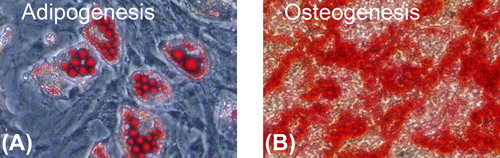 Figure 3. Multiple differentiation of rat cultured BMSCs (original amplification: × 200). A: After 14 days of induction, adipogenesis was indicated by the accumulation of neutral lipid vacuoles with oil red O staining. B: After 21 days of induction, osteogenesis was indicated by a mass of red calcium salinity accumulation with alizarin red staining.