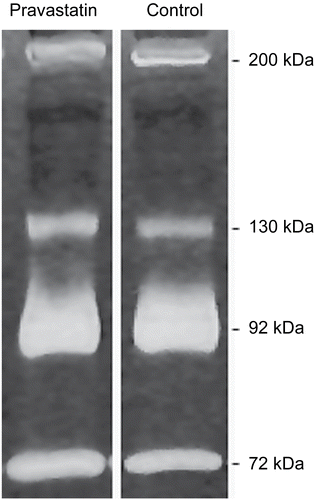 Figure 1.  The serum gelatinolytic activity in zymography assay. Zone of clear bands corresponds with protease activity at 72 kDa (pro-MMP-2), 92 kDa (pro-MMP-9), 130 kDa (MMP-9 heterodimer) and 200 kDa (MMP-9 homodimer). Pravastatin line represents zymogram after an 18-h incubation with pravastatin 5 μg/mL versus incubation with conventional buffer only (control).