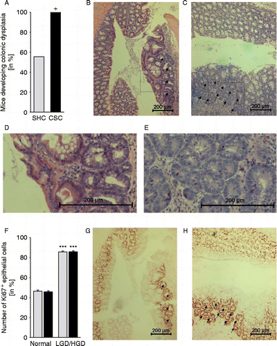 Figure 2.  Effects of chronic psychosocial stress on colonic morphology and relative epithelial cell proliferation. Both SHC (n = 9, gray bars) and CSC housing (n = 7, black bars) mice were killed on day 186 following three cycles of DSS administration. (A) Hematoxylin–eosin stained paraffin sections of the distal colon were evaluated by an experienced pathologist with respect to the development of low-grade dysplasia (LGD; black arrows in B; section surrounded by the rectangle in (B) is shown in higher magnification in (D) and/or high-grade dysplasia (HGD; black arrows in (C); section surrounded by the rectangle in (C) is shown in higher magnification in (E). Data represent percentage of mice developing colonic dysplasia (HGD and/or LGD; +p = 0.069 vs. respective SHC mice; Fisher's exact test). (F) Relative epithelial cell proliferation was assessed in Ki67-stained paraffin sections by determining the percentage of Ki67+ cells per cross-sectioned crypt in non-dysplastic tissue (normal, G&H) and LGD (indicated by arrows in G)/HGD (indicated by arrows in H). Data represent mean+SEM. ***p < 0.001 vs. respective non-dysplastic (normal) tissue mice (two-way ANOVA, factor treatment group and factor dysplasia).