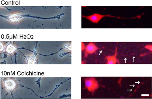 Figure 6. Localization of mitochondria in hydrogen peroxide-treated neuro2a cells. Neuro2a cells were treated with 0.5 μM of hydrogen peroxide. After 24 h, the cells were incubated with 200 μM Mito Tracker® for 15 min in CO2 incubator and were fixed with 4% PFA in PBS for 15 min in 4°C. In order to check the status of nucleus, 1 μM Hoechst 33258 was used as nucleus stain. For positive control sample, the cells were treated with 10 nM colchicine for 24 h. Phase-contrast (left) or fluorescence photomicrographs (right) were taken. Scale bar is 10 μm. The arrows show neurite beadings. The detailed method is described in Materials and methods.